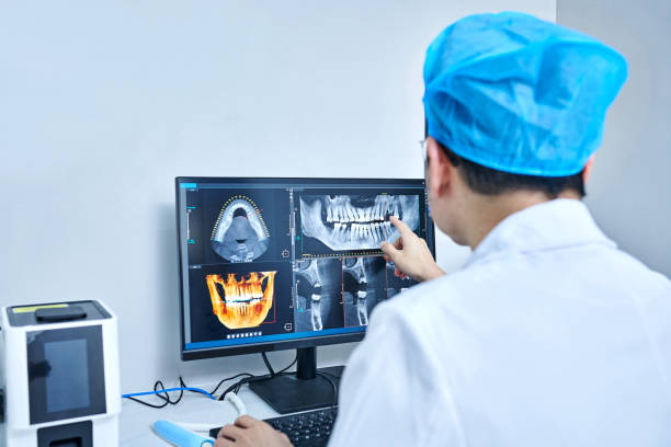 Best Knocked-Out Tooth (Avulsed Tooth) Treatment in Little Cypress, TX